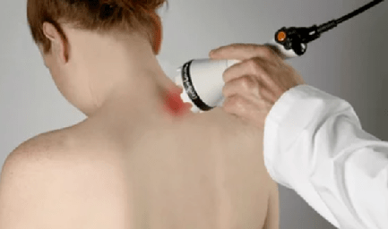 Treatment of cervical osteochondry with physiotherapy