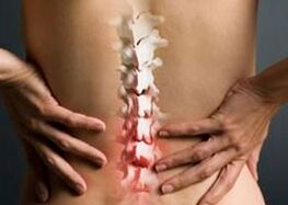 What is the difference between arthritis of the spine and arthritis